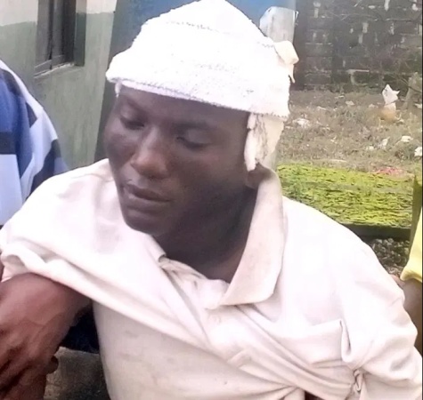 Two women, vigilantes in police net for allegedly beating, burning of 20-year-old boy