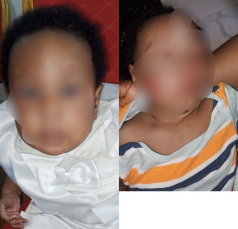 Baby battles for life after alleged animal bite in Lagos daycare