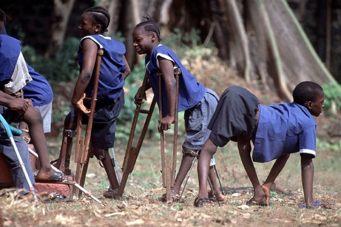 70 polio variants recorded in 14 northern states ? FG