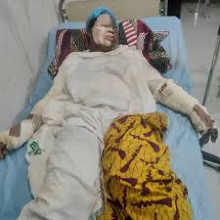 Ebonyi gas explosion claims one life, burns nine others