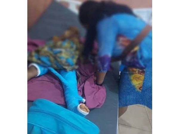 Police arrest woman who broke stepson?s bone with pestle