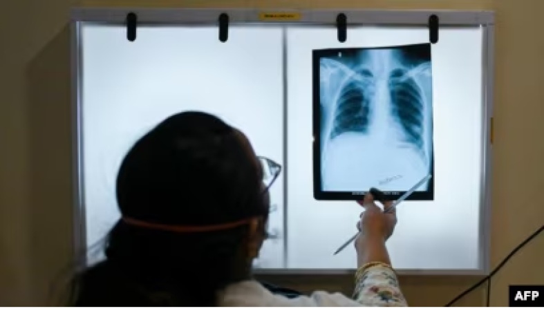 Record 8 million people diagnosed with TB in 2023, WHO reports