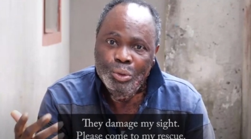 Man seeks justice after radiotherapy at UCH damaged his sight