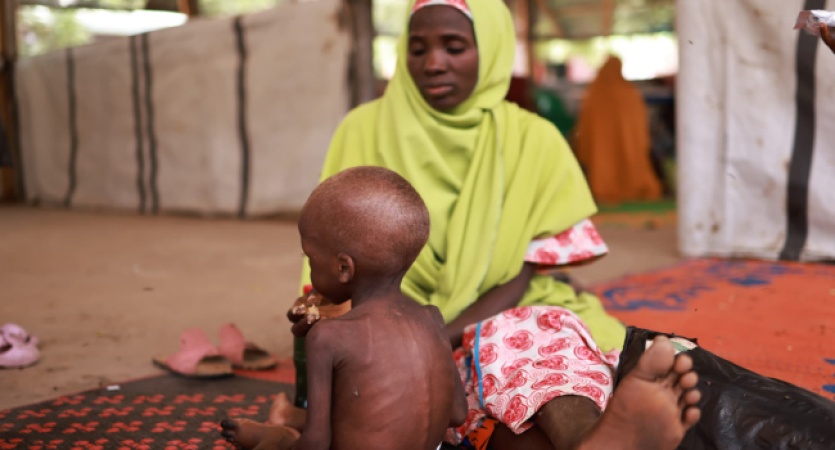 294,000 children treated for extreme malnutrition in parts of North-West Nigeria: Survey