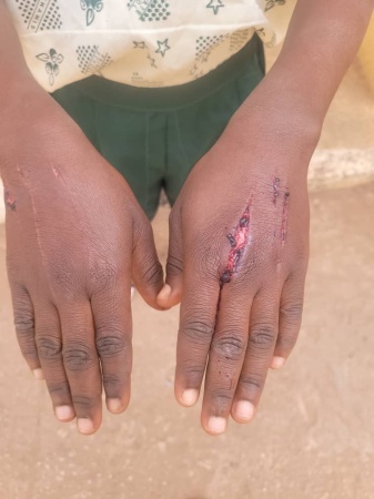 Woman inflicts razor blade wounds on 10-year-old boy for stealing N600