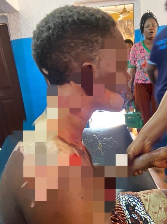 Man pours hot oil on wife, stabs her in the head during domestic dispute