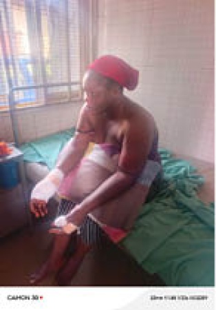 Man cuts off woman?s finger after seeing her with his friend