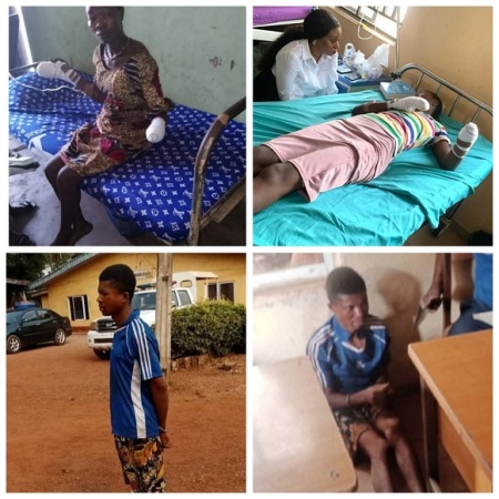 Enugu Govt. detains man who allegedly chopped off wife?s hand