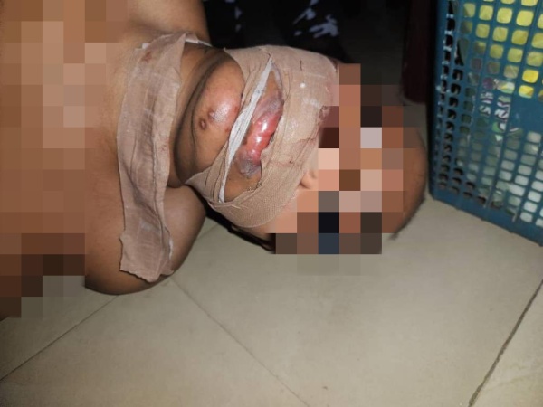 Police storm Abuja hotel room, rescue woman from suspected ritualist