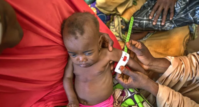80,000 malnourished children in Nigeria risk losing aid ? UNICEF