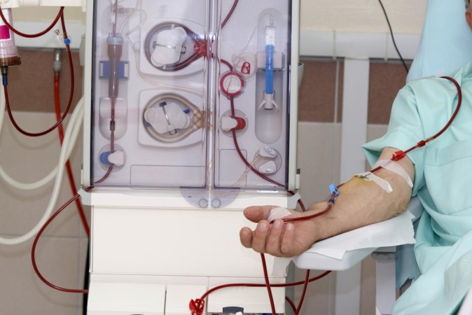 Patients struggle with dialysis bills as FG?s subsidy stalls