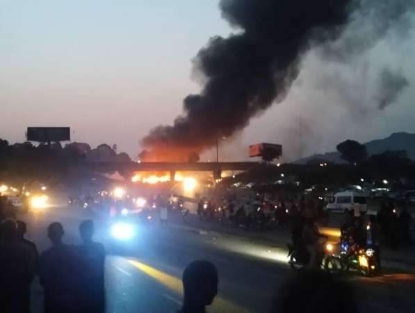 Karu Bridge accident victim: Nigerians are strange people; those who should rescue us were busy taking videos
