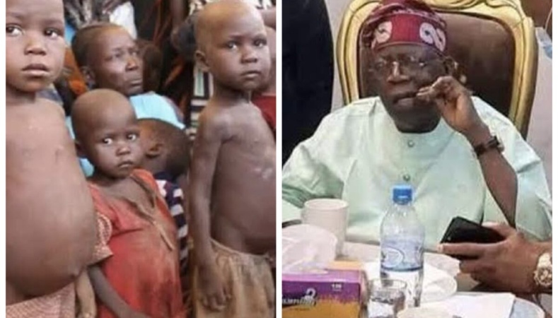 UNICEF: Nigeria beats war-ridden Sudan to emerge capital of malnourished children in Africa