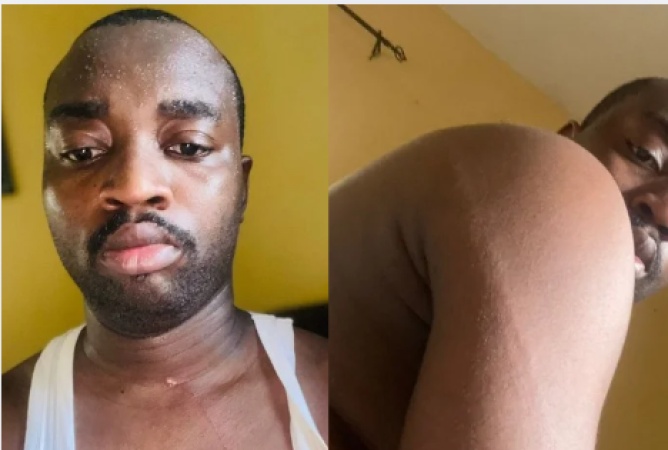 Outrage as police officer flogs injured man for 30 minutes in Abuja