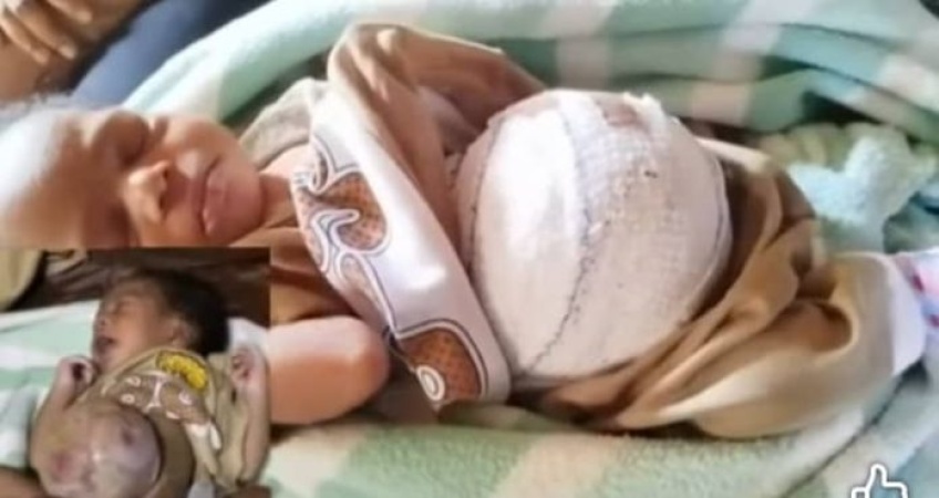 Baby born with intestines outside stomach urgently needs N3m for surgery