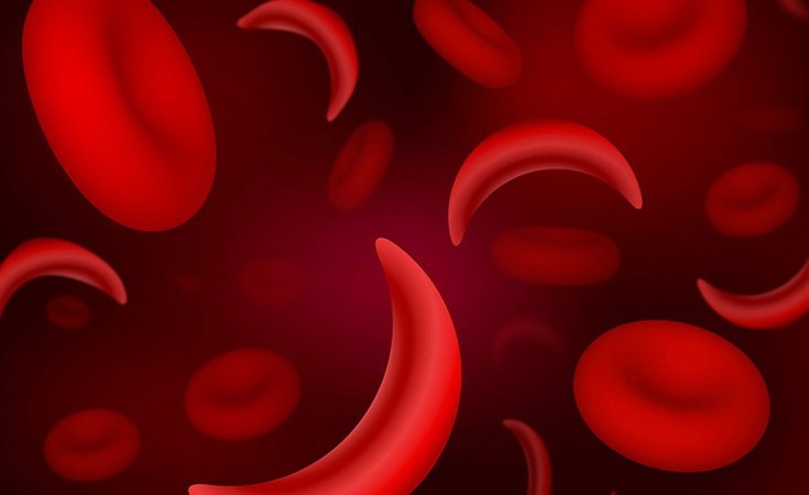 Nigeria records highest cases of sickle cell globally