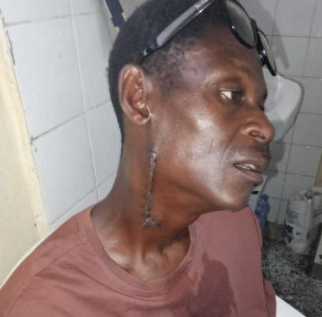 Cross River?s shooting survivor cries out after police officer?s attack