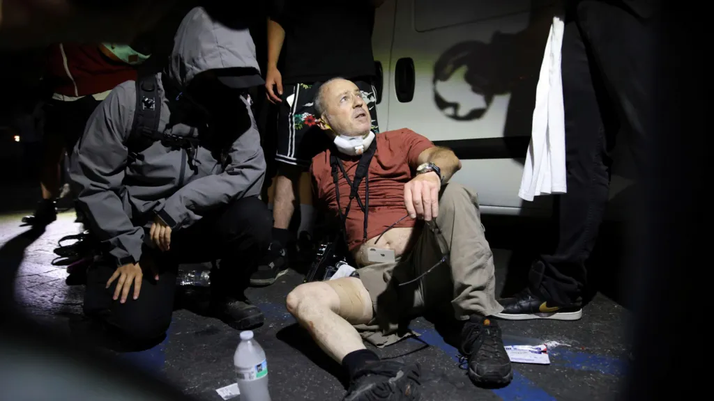 British photographer injured by 'plastic bullet' in LA protests