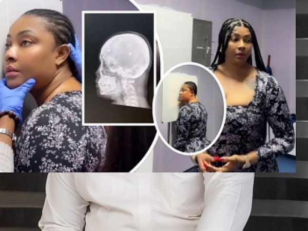 Bullet fragments still in my head after 2019 gun attack ? Actress Angela Okorie