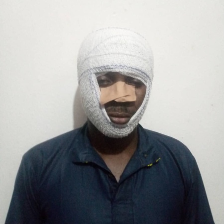 ?This was attempted murder?: Edo Activist Okhai Okhani speaks out after brutal attack