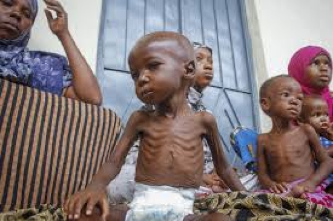 51.9 per cent of Kano children stunted by malnutrition ? UNICEF