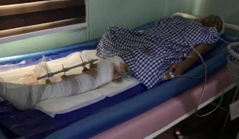 Dangote reaches out to BBNaija Phyna?s sister knocked down by Dangote truck driver