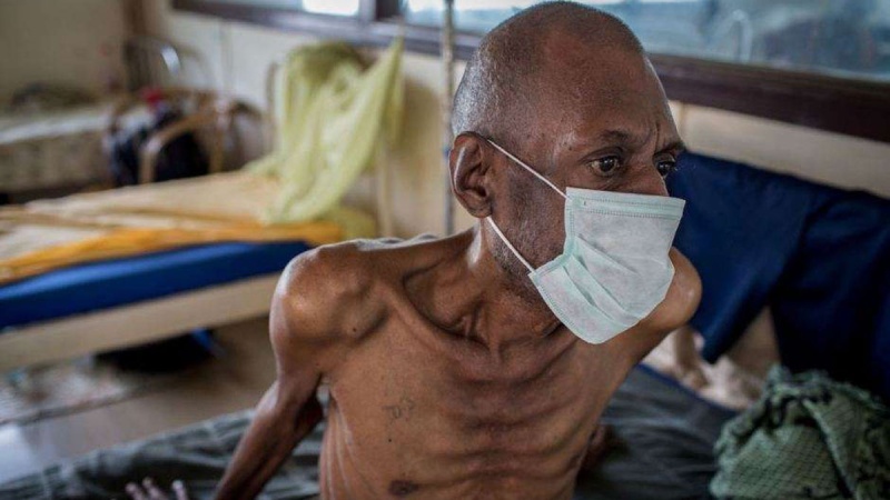 Nigeria records about 500,000 cases of TB annually ? Health expert