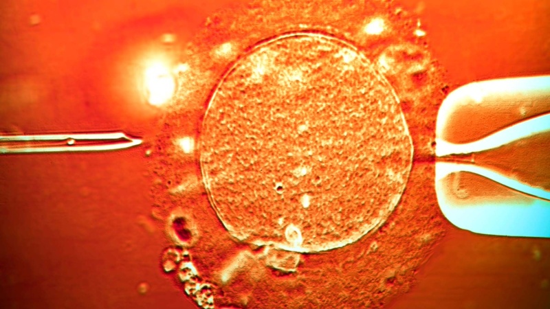 Sperm from donor with cancer-causing gene was used to conceive almost 200 children