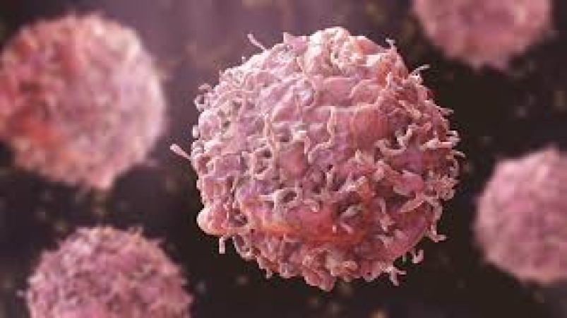 FULL LIST: 30 controllable factors that cause cancer