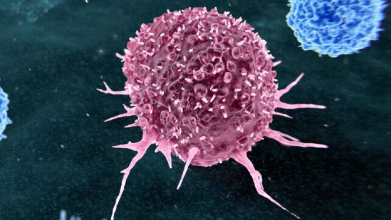 Most preventable cancers are linked to just two lifestyle habits