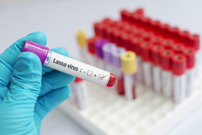75 die of Lassa Fever in seven weeks, says NCDC
