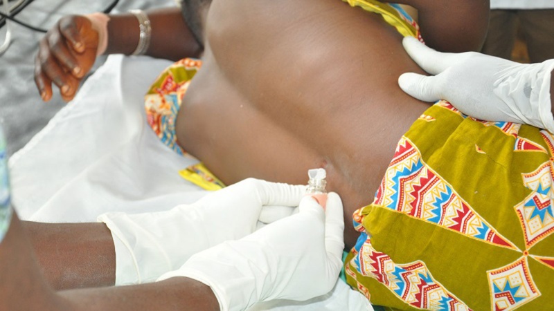 NCDC Issues health advisory on Cerebrospinal Meningitis outbreak