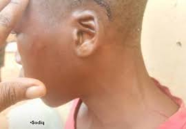Outrage after security guard smashes 13-year-old son’s head against toilet’s water closet