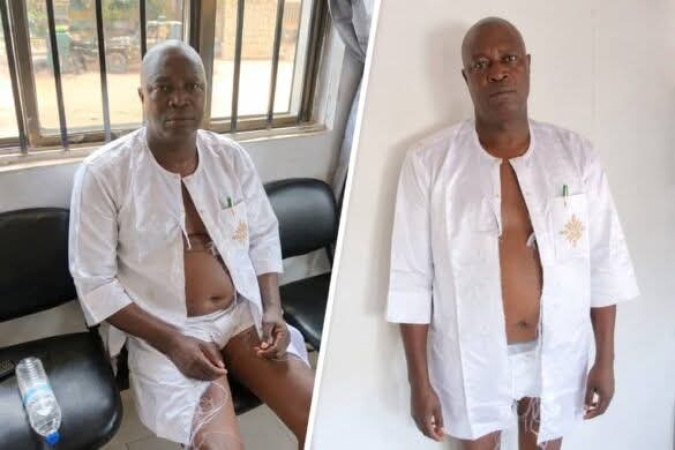Suspected thugs beat, strip Ondo LG chairman