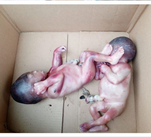 Newborn twins found dead in Anambra drainage, parents taken into custody