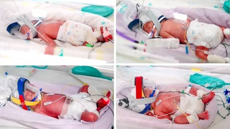 Rare identical quadruplets born in Australia