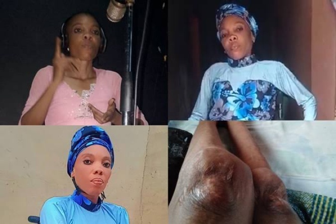 How a mysterious illness changed my life at 20 — Nkechi Triumph recounts 26-year battle