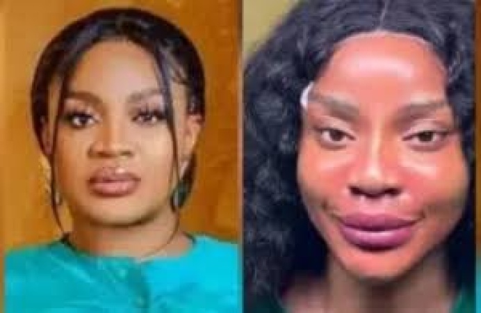 Nollywood actress Uche Ogbodo transforms face