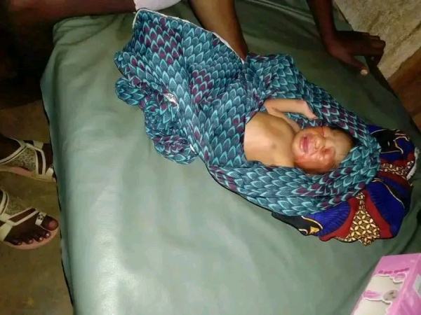 Abandoned newborn rescued from Benue forest