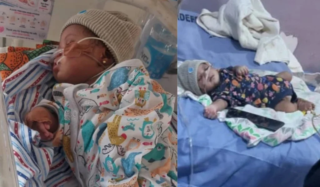 Family seeks N17m financial assistance for three-month-old’s heart surgery