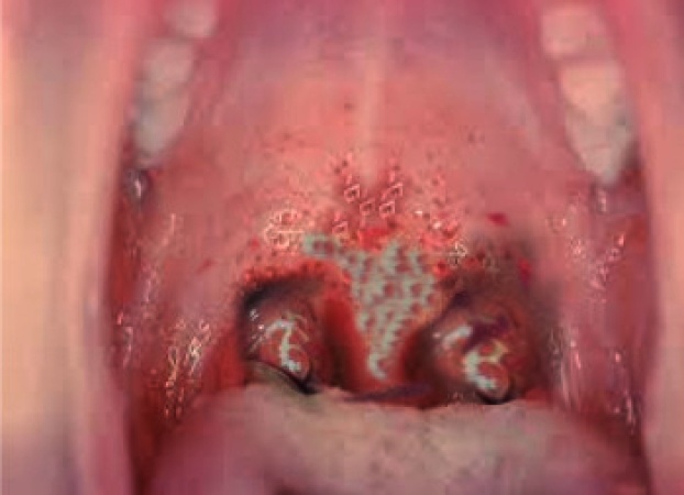 Diphtheria: Kano, Borno, Plateau, five others contribute 98 per cent of confirmed cases in Nigeria — NCDC