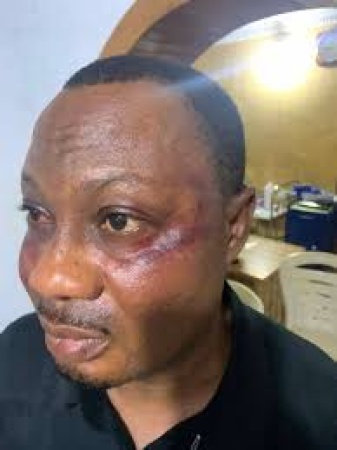 Family accuses LASUTH of negligence over accident victim’s death