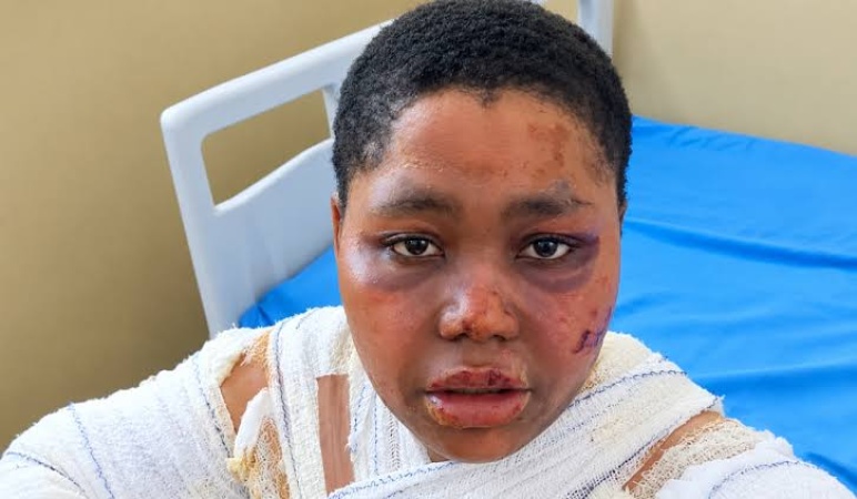 Rivers gas explosion: Lawyers seek probe into Joy Amos’ death, demand emergency action