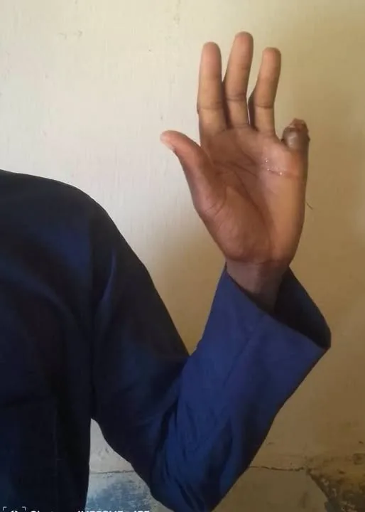Man cuts off own finger over N80m ‘occult deal’