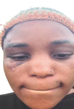 How I escaped after gunmen abducted 16 victims — Hairstylist