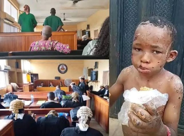 Couple pleads not guilty to unlawfully causing grievous harm to 11 years old house help, others in Anambra