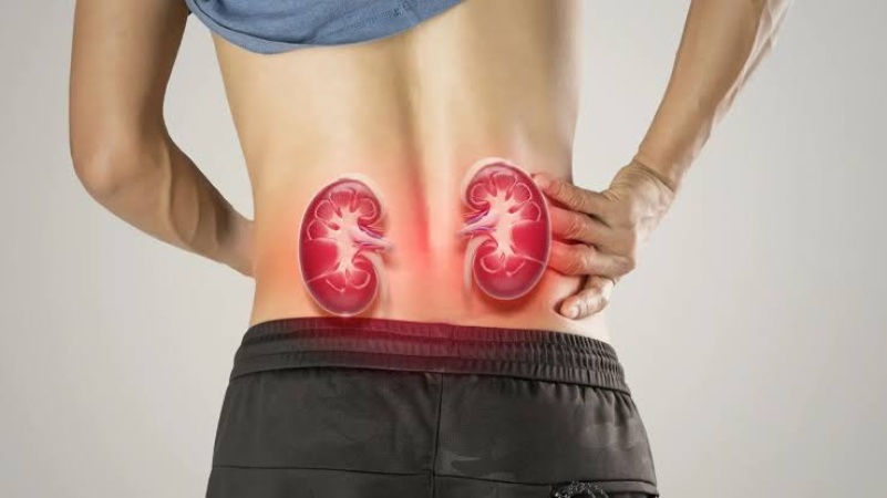 Nigeria records 9,000 new cases of end-stage kidney failure every month — Medical expert