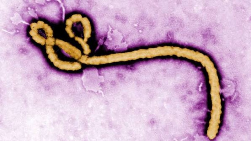 Ebola: We have a problem with delayed diagnosis, resources to cope — Medical Doctor