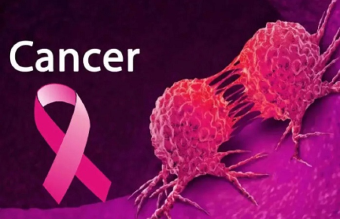 Breast Cancer: We record four new cases weekly — Kwara Surgeon