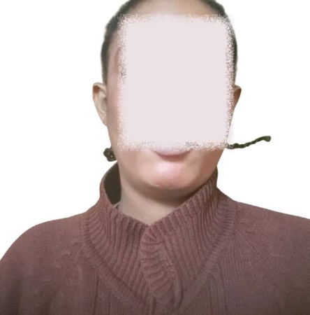 Help! I have no vaginal opening for sex – Graduate seeking surgery